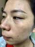 茜妃云南本草黄芪霜老牌子国货美白祛斑霜套装去黄淡斑去斑淡化黑色素 【60g单独祛斑霜】2瓶 实拍图