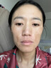 洛娅5%氨甲环酸精华液传明酸湿敷液补水保湿黄褐斑面部烟酰胺提亮肤色 1瓶装/100ml 实拍图