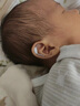 东祝今康耳朵矫正器婴儿新生儿耳廓矫正器宝宝耳朵定型矫正器矫正贴纠正 耳撑两只+压敏胶带（垂耳/耳廓畸形用） 【调整塑型 适配性强】 实拍图