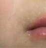 BEAUTY NOTES儿童润唇周膏补水保湿滋润嘴唇宝宝防干裂起皮男女孩淡化唇纹 实拍图