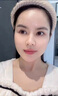 贝玲美377美白淡斑抗皱套装祛斑去黄提亮暗沉肤色淡纹紧致精华水乳组合 377精华液*2 实拍图