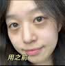 素秀臣氏眼膜眼袋提拉紧致抗皱淡化细纹黑眼圈消去除神器男女士眼贴膜60片 实拍图