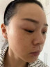 花恩诗美白祛斑霜淡斑雀斑黄褐斑晒斑妊娠斑淡化黑色素高维美白祛斑面霜 三盒【中度祛斑】 实拍图
