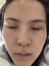 佰萃莱烟酰胺凝胶可搭复方熊果苷乳霜膏脸部美色斑白南皮研所非医用50g 实拍图
