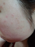 透真积雪草水乳护肤套装B5保湿补水乳晒后修复修护敏肌控油胖东来女 实拍图