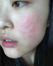 华美科医用修复皮肤屏障受损泛红晒后面霜精华液洁面慕斯敏感肌护肤套装 实拍图