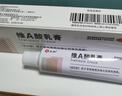 仁和 维A酸乳膏0.05%*15g*1盒 祛痘膏痤疮去闭口粉刺黑色素改善鸡皮青春痘丘疹脓疱暗疮痘痘药膏祛痘凝胶 实拍图