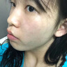珂语祛痘精华液清痘凝胶小绿瓶去痘痘和痘印收敛毛孔修护青少年青春痘 【董璇推荐】祛痘凝胶1盒6支 实拍图