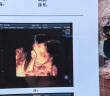 童泰（TONGTAI）婴儿连体衣夏季新生儿衣服宝宝家居内衣蝴蝶衣2件装 蓝色52cm 晒单实拍图