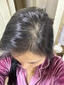 人仁生发液激活毛囊增发密发长发剂防脱生发洗发水斑秃生发男女士专用 拍二发三周期装【增发神器】 实拍图