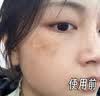 茜妃云南本草黄芪霜老牌子国货美白祛斑霜套装去黄淡斑去斑淡化黑色素 【60g单独祛斑霜】2瓶 实拍图
