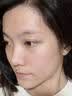 奢泉美冷敷贴微整术后修护红肿花敏晒后过敏瘙痒肌肤敏感肌肤院线产品女 奢泉美医用冷敷贴 一盒【5片】 实拍图