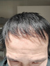 soul special假发男 真发假发片 补发块 男士补发真发头顶补发片隐形补发块 高透气精修自然款 18*20 直接戴 自然黑 实拍图