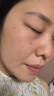 乐家老铺志清清可搭温和点痣去痣膏痕疤液无痕无痛脸部祛痣膏黑痣雀斑使用 痣少-小痣-雀斑适用1盒装 实拍图