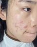 DR.XME 向美博士硫磺洗面奶男女士收缩毛孔去黑白头控油清洁螨虫祛痘去角质洁面乳 1瓶体验装【日常清洁控油除螨】 实拍图