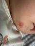 优色林（Eucerin）婴儿身体霜宝宝身体润肤乳141g呵护肌肤 缓解红痒 实拍图