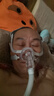 鱼跃（Yuwell）呼吸机原装面罩通用型鼻罩口鼻面罩家用呼吸器配件 鼻面罩升级款YN-03 L码（大码看主图尺寸购买） 实拍图