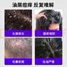 力仕康(LEASCAN)1%二硫化硒洗发水去屑控油抑制马拉色菌头油头痒毛囊痘 实拍图