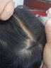贝德美蓝甘菊儿童洗发水护发素 3-4-6-12岁氨基酸无硅油男女孩335ml套装 实拍图