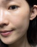 ORGINESE祛痘膏平痘印痘坑复修改善粉刺闭口痘痘和痘印精华男女礼物 实拍图