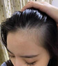 露卡菲娅防脱精华液养护男女士通用呵护头皮正爱养护稳固发根防脱液 1瓶【基础装】 防脱精华液 实拍图