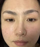 医用冷敷贴面膜型械字号透明质酸钠修复贴敷料医美术后消炎去红美白补水晒后修复收缩毛孔祛痘控油淡化痘印 实拍图