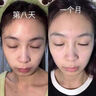 维特丝（vetes）377面膜美白补水淡斑提亮肤色女男士抗干皱紧致补水面膜店铺第1名 【专研377&国货之光】20片 实拍图