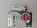 云标堂口腔溃疡专用喷剂药监备案口舌生疮牙龈肿痛口腔溃疡喷雾贴凝胶 实拍图