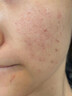 BEAUTY NOTES天然芦荟胶补水保湿晒后2盒装 实拍图