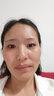南京同仁堂祛痘膏去痘痘和痘印淡化痘印痘坑修复药膏男女士改善粉刺闭口 一盒【三盒一周期】拍2盒、发3盒 实拍图