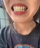 黑黄 牙斑净正品洗牙齿美白速效去黄洁牙粉去烟渍神器去黑洗牙水 牙斑净牙齿美白神器（一瓶） 可去【牙结石】 实拍图