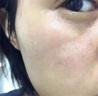 东田老年斑专用的膏药一夜消强力去除美白祛斑霜脸部手部背黄褐斑男士 【1盒装】试用装特效膏 除斑液祛斑点防晒黑色素老人斑 实拍图