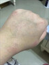 同仁堂湿疹止痒软膏 阴囊潮湿皮炎皮癣肛周肛门阴部私处皮肤瘙痒成人 实拍图