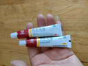 马应龙尿素乳膏10%20g/盒 尿素软膏尿素霜医用尿素乳膏手脚干裂干燥手足皲裂脚后跟干裂膏角化型脚气 实拍图