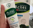 曼秀雷敦（Mentholatum）乐肤洁隐形痘痘贴遮瑕抗痘祛痘日夜双效52片吸脓隐形女生约会神器 实拍图