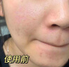 韩方五谷377美白补水保湿精华液次抛祛斑提亮去黄护肤品抗氧烟酰胺男女士 实拍图