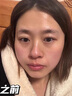 焦博士日本眼霜去眼袋消除重度眼袋专用黑眼圈重度去除女男士中老年神器 实拍图