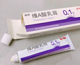 丽芙维a酸乳膏0.025%10g+尿素乳膏10g去祛痘药膏医用淡化痘印黑头去鸡皮肤黑色素可搭异维A酸凝胶囊 实拍图
