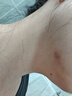 维德（WELLDAY）硅凝胶医用疤痕贴剖腹产去黑色素沉淀专用助修复祛疤贴2X12cm*2片 实拍图