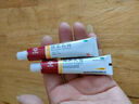 马应龙尿素乳膏10%20g/盒 尿素软膏尿素霜医用尿素乳膏手脚干裂干燥手足皲裂脚后跟干裂膏角化型脚气 实拍图