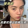 透真377美白精华液次抛淡化黑色素祛斑去黄提亮改善暗沉肤色烟酰胺女 实拍图