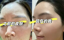 OHBT黄芪面膜10片抗皱紧致抗衰老补水熬夜美白淡斑女男士金榜第1名 实拍图