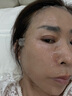 FANCIE MANLIN医用修复面膜械字号水光针熬夜军训晒后医美激光术后点痣斑敏感肌 5盒装【25贴】 实拍图