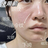 秀瑟祛皱抗皱精华液淡化细纹去皱纹鱼尾纹祛法令纹眼纹4D生物酶注氧液 1瓶装【日常维稳】 实拍图