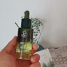 维特丝愈创木祛痘控油修护保湿乳液淡化痘印去痘痘收缩毛孔男女士护肤品 实拍图
