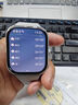 小米（MI）REDMI Watch 5 典雅黑 国家补贴 澎湃OS 2 心率血氧监测 蓝牙通话 红米手表5 智能手表 小米汽车 实拍图