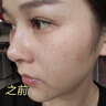 透真377美白精华液次抛淡化黑色素祛斑去黄提亮改善暗沉肤色烟酰胺女 实拍图