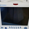 瑞博PM-9000A+12.1寸多参数监护仪心电监护仪家用医用监护仪 标配（含电池） 实拍图