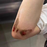 久卜制药祛痘膏痘坑印去黑头淡化黑色素沉淀痤疮修复疤痕青少年青春痘1盒 实拍图