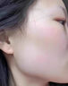 越洋点痣膏不留疤去痣无痕官方正品黑痣肉痣痦子专用香港大药房 实拍图